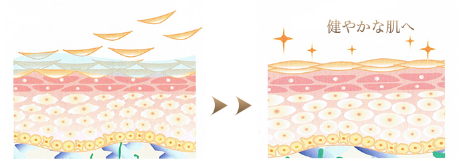 ケミカルピーリング